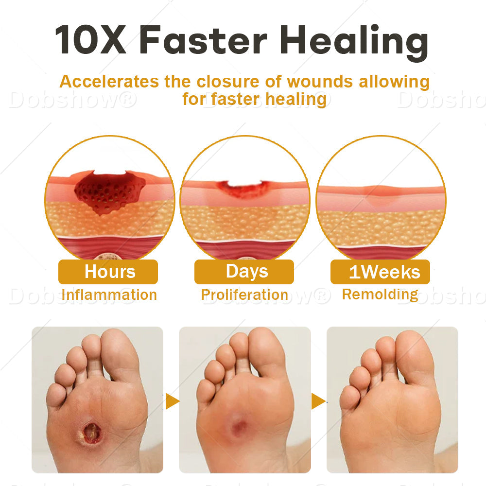 🏆 Najbolj prodajano 🔥 | Tainun® GlucoShield Čebelji strup pršilo za nego ran 🎉 Posebni časovno omejeni popust – ne zamudite!