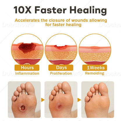 🏆 Najbolj prodajano 🔥 | Tainun® GlucoShield Čebelji strup pršilo za nego ran 🎉 Posebni časovno omejeni popust – ne zamudite!