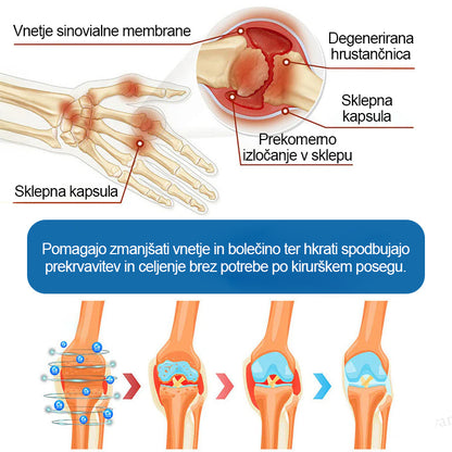 Twisma® BPC-157 krema za regeneracijo sklepov 🦴 Pomaga pri artritisu, nevropatiji, revmatizmu, športnih poškodbah in drugih težavah 🦵 | Zadnji dan akcije – 80 % POPUST | 🏆