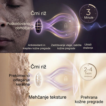 ✨ Twisma® Crema Pro za odstranjevanje bradavic in madežev 🧑‍⚕️ Hitro olajšanje in vidni rezultati že v samo 2 tednih