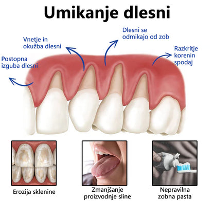 🌟Twisma® VioCore Propolis zobna pasta 🦷 Olajšanje zobobola v 3 dneh · 7-dnevna obnova dlesni · Preprečevanje parodontalne bolezni · Popolna kombinacija čebeljega strupa in naravnih mineralov