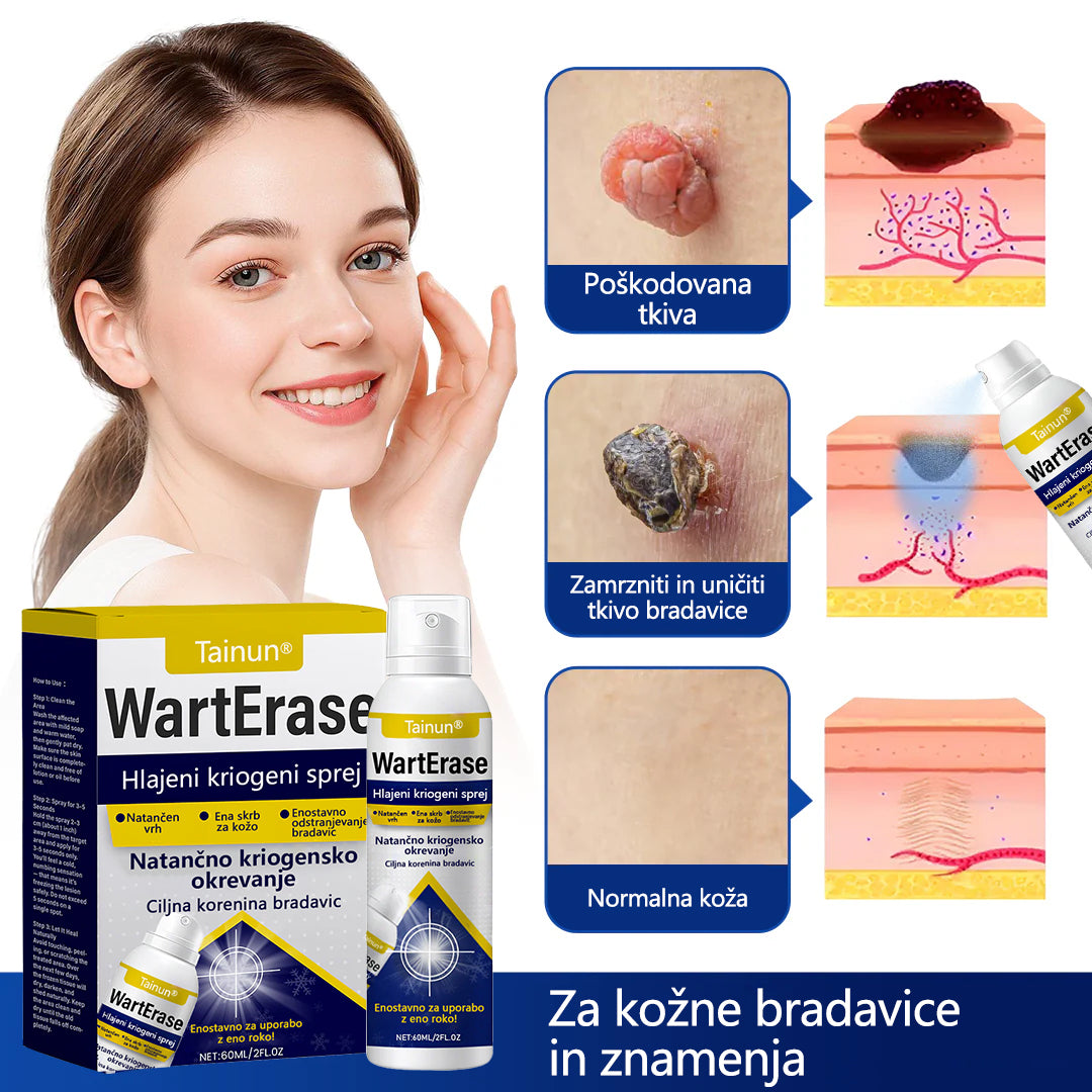 Tainun® ChillErase – spray za obnovo brazgotin po aknah ✨ | Varno odstranjuje kožne oznake, madeže & bradavice doma ✅