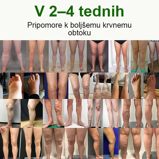 Poslovite se od otečenih, bolečih nog – Healrize® FluidEase Professional Krema za cirkulacijo nog prinaša pravo olajšanje! 🦵🌿