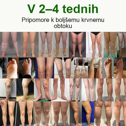 Poslovite se od otečenih, bolečih nog – Healrize® FluidEase Professional Krema za cirkulacijo nog prinaša pravo olajšanje! 🦵🌿