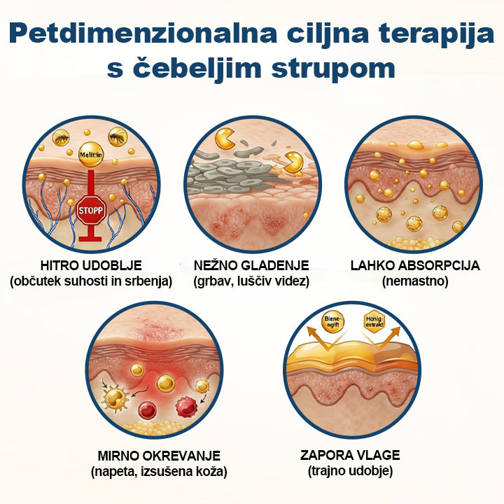 Twisma® Krema s čebeljim strupom za luskavico✨ Comfort-first nega kožne bariere za suho, luskasto in srbečo kožo — brez steroidov · nežna · primerna za vsakodnevno uporabo 💧