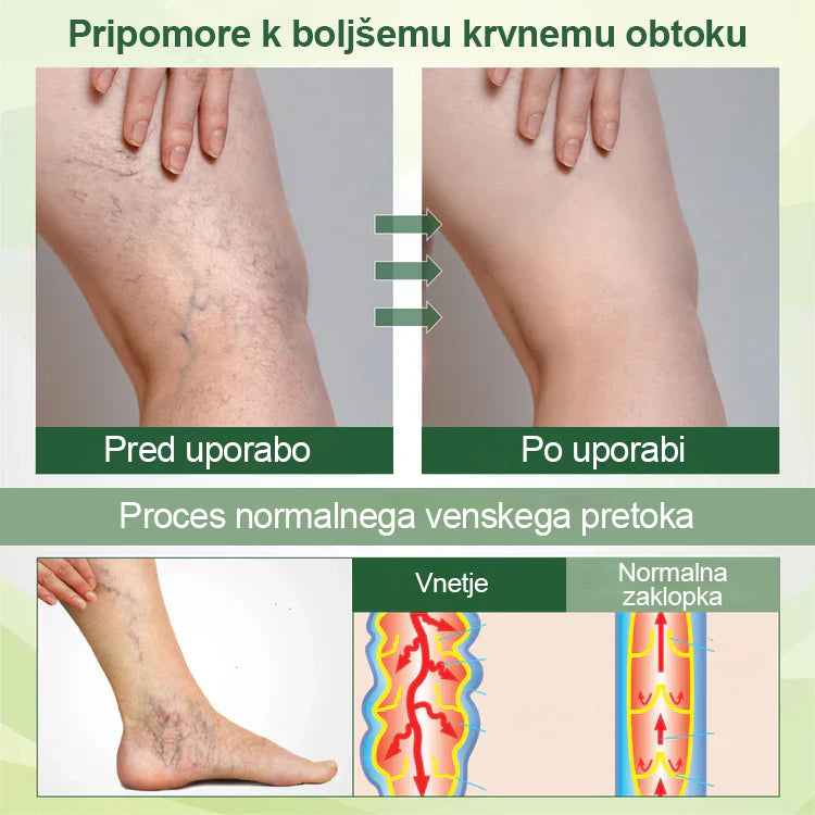 Poslovite se od otečenih, bolečih nog – Healrize® FluidEase Professional Krema za cirkulacijo nog prinaša pravo olajšanje! 🦵🌿