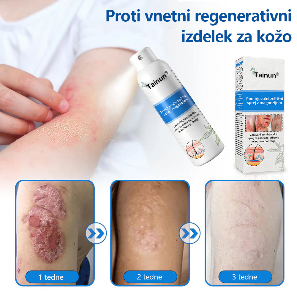 Tainun® Magnezijev zeliščni sprej ✅ CE certifikat – za zdravljenje luskavice (lajšanje luskavice in ekcemov, izboljšanje bakterijskih okužb genitalnega območja, zdravljenje aken in bradavic, lajšanje bolečin v sklepih in nevropatskih bolečin)