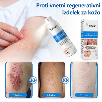 Tainun® Magnezijev zeliščni sprej ✅ CE certifikat – za zdravljenje luskavice (lajšanje luskavice in ekcemov, izboljšanje bakterijskih okužb genitalnega območja, zdravljenje aken in bradavic, lajšanje bolečin v sklepih in nevropatskih bolečin)