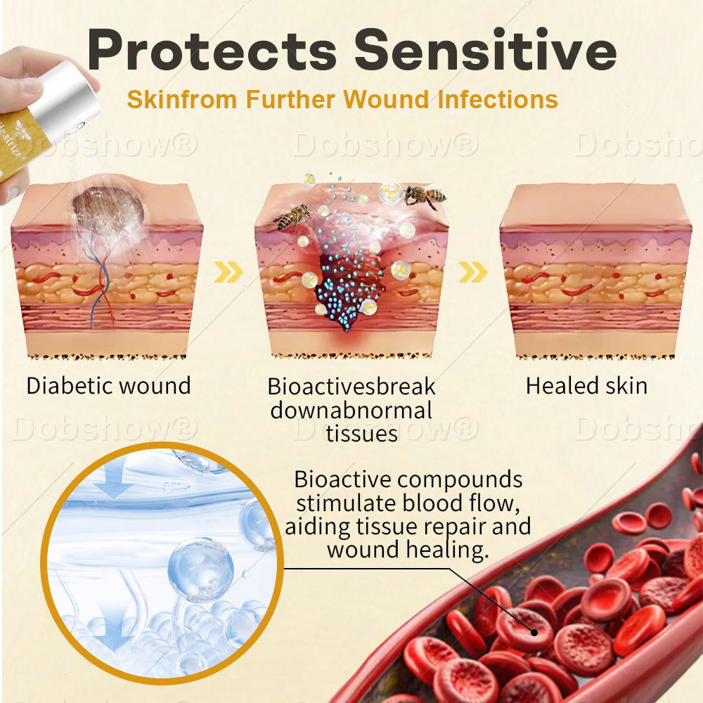 🏆 Najbolj prodajano 🔥 | Tainun® GlucoShield Čebelji strup pršilo za nego ran 🎉 Posebni časovno omejeni popust – ne zamudite!
