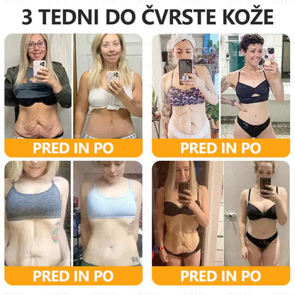 🌷 Izdelano in poslano iz Slovenije – 🐝 Twisma® Krema z naravnim čebeljim strupom za regeneracijo kože 🔥🔥 ZADNJI DAN – 80 % POPUST!