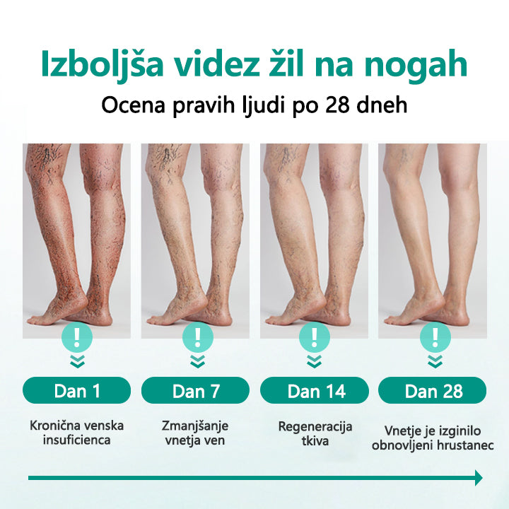 Tainun® LegRenew obliž za krčne žile izboljša zdravje ven in odpravi krčne žile – brez operacije