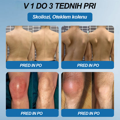 Twisma® BPC-157 krema za regeneracijo sklepov 🦴 Pomaga pri artritisu, nevropatiji, revmatizmu, športnih poškodbah in drugih težavah 🦵 | Zadnji dan akcije – 80 % POPUST | 🏆