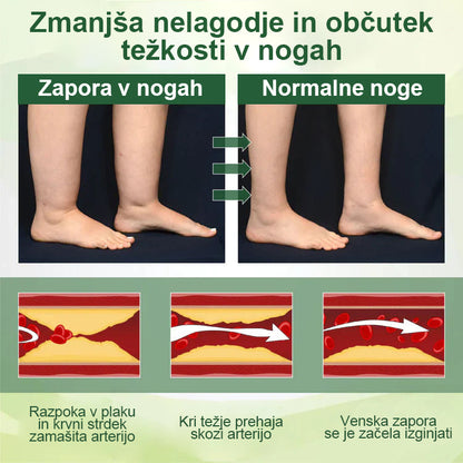 Poslovite se od otečenih, bolečih nog – Healrize® FluidEase Professional Krema za cirkulacijo nog prinaša pravo olajšanje! 🦵🌿