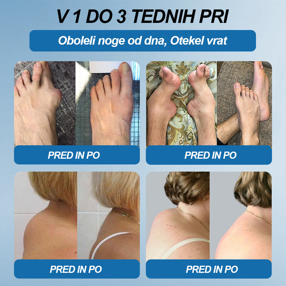 Twisma® BPC-157 krema za regeneracijo sklepov 🦴 Pomaga pri artritisu, nevropatiji, revmatizmu, športnih poškodbah in drugih težavah 🦵 | Zadnji dan akcije – 80 % POPUST | 🏆