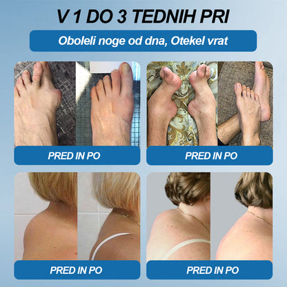 Twisma® BPC-157 krema za regeneracijo sklepov 🦴 Pomaga pri artritisu, nevropatiji, revmatizmu, športnih poškodbah in drugih težavah 🦵 | Zadnji dan akcije – 80 % POPUST | 🏆