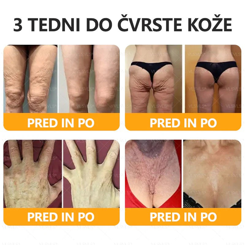 🌷 Izdelano in poslano iz Slovenije – 🐝 Twisma® Krema z naravnim čebeljim strupom za regeneracijo kože 🔥🔥 ZADNJI DAN – 80 % POPUST!