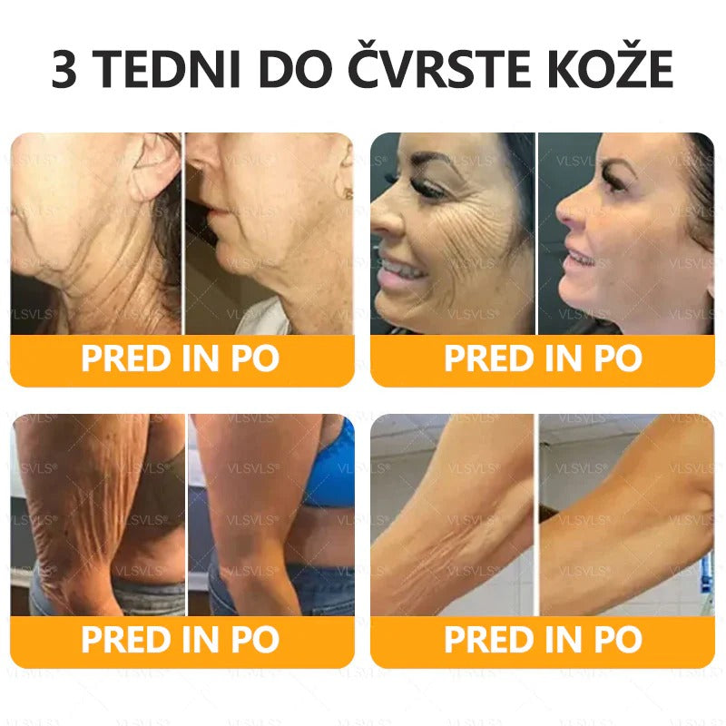 🌷 Izdelano in poslano iz Slovenije – 🐝 Twisma® Krema z naravnim čebeljim strupom za regeneracijo kože 🔥🔥 ZADNJI DAN – 80 % POPUST!