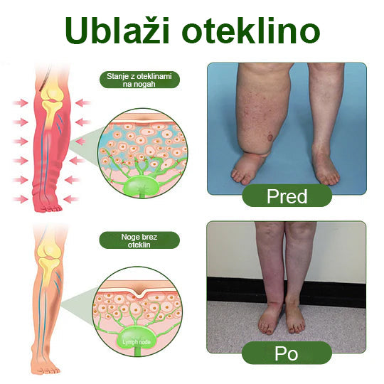 Poslovite se od otečenih, bolečih nog – Healrize® FluidEase Professional Krema za cirkulacijo nog prinaša pravo olajšanje! 🦵🌿