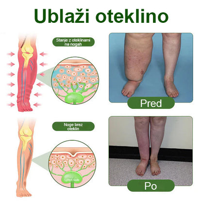Poslovite se od otečenih, bolečih nog – Healrize® FluidEase Professional Krema za cirkulacijo nog prinaša pravo olajšanje! 🦵🌿