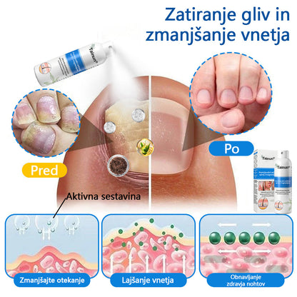 Tainun® Magnezijev zeliščni sprej ✅ CE certifikat – za zdravljenje luskavice (lajšanje luskavice in ekcemov, izboljšanje bakterijskih okužb genitalnega območja, zdravljenje aken in bradavic, lajšanje bolečin v sklepih in nevropatskih bolečin)