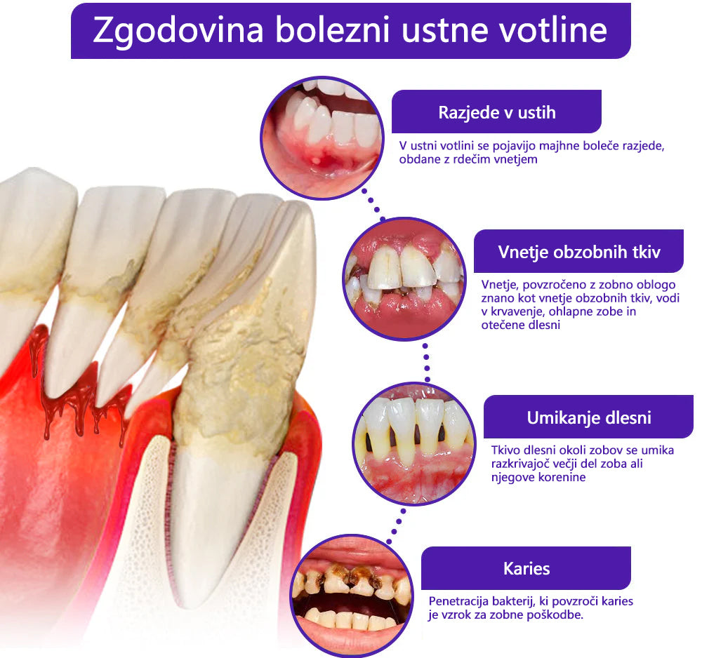 🌟Twisma® VioCore Propolis zobna pasta 🦷 Olajšanje zobobola v 3 dneh · 7-dnevna obnova dlesni · Preprečevanje parodontalne bolezni · Popolna kombinacija čebeljega strupa in naravnih mineralov
