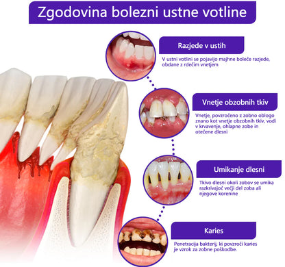 🌟Twisma® VioCore Propolis zobna pasta 🦷 Olajšanje zobobola v 3 dneh · 7-dnevna obnova dlesni · Preprečevanje parodontalne bolezni · Popolna kombinacija čebeljega strupa in naravnih mineralov