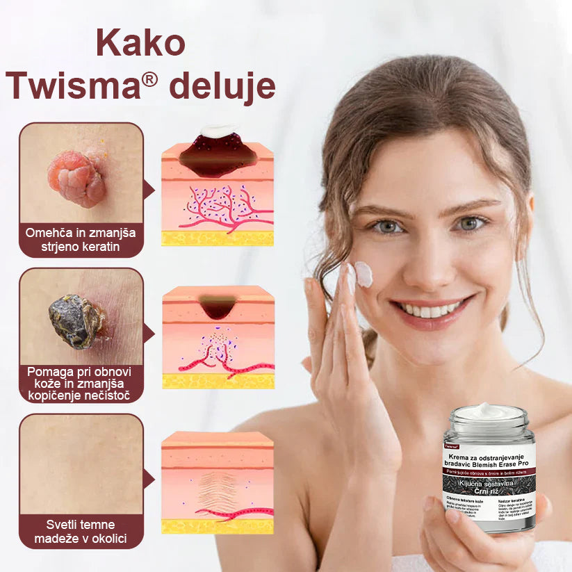 ✨ Twisma® Crema Pro za odstranjevanje bradavic in madežev 🧑‍⚕️ Hitro olajšanje in vidni rezultati že v samo 2 tednih