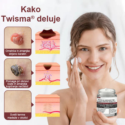 ✨ Twisma® Crema Pro za odstranjevanje bradavic in madežev 🧑‍⚕️ Hitro olajšanje in vidni rezultati že v samo 2 tednih