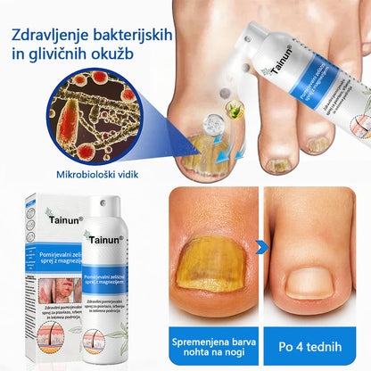Tainun® Magnezijev zeliščni sprej ✅ CE certifikat – za zdravljenje luskavice (lajšanje luskavice in ekcemov, izboljšanje bakterijskih okužb genitalnega območja, zdravljenje aken in bradavic, lajšanje bolečin v sklepih in nevropatskih bolečin)