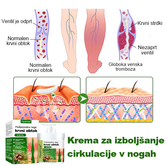 Poslovite se od otečenih, bolečih nog – Healrize® FluidEase Professional Krema za cirkulacijo nog prinaša pravo olajšanje! 🦵🌿