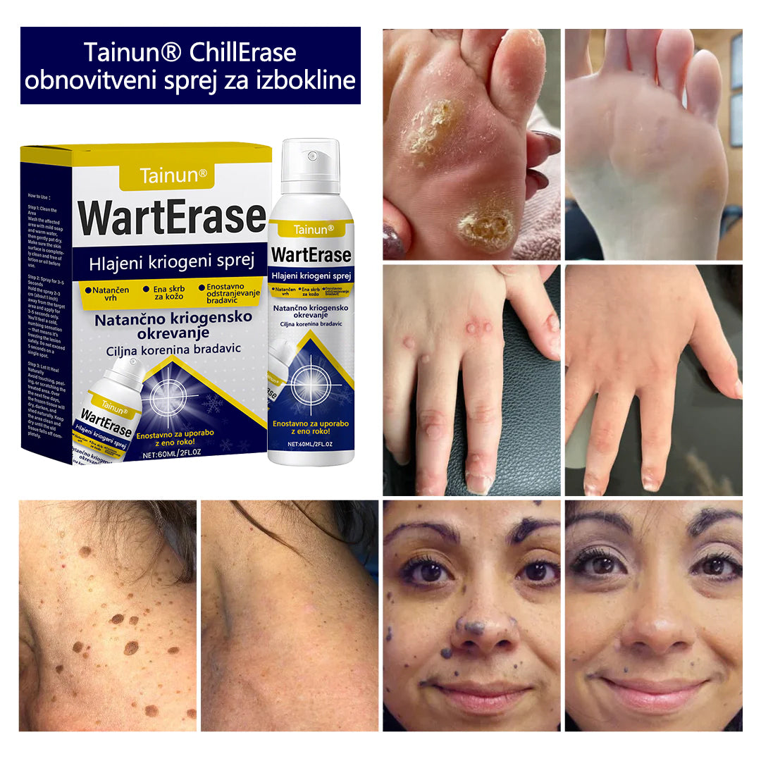 Tainun® ChillErase – spray za obnovo brazgotin po aknah ✨ | Varno odstranjuje kožne oznake, madeže & bradavice doma ✅