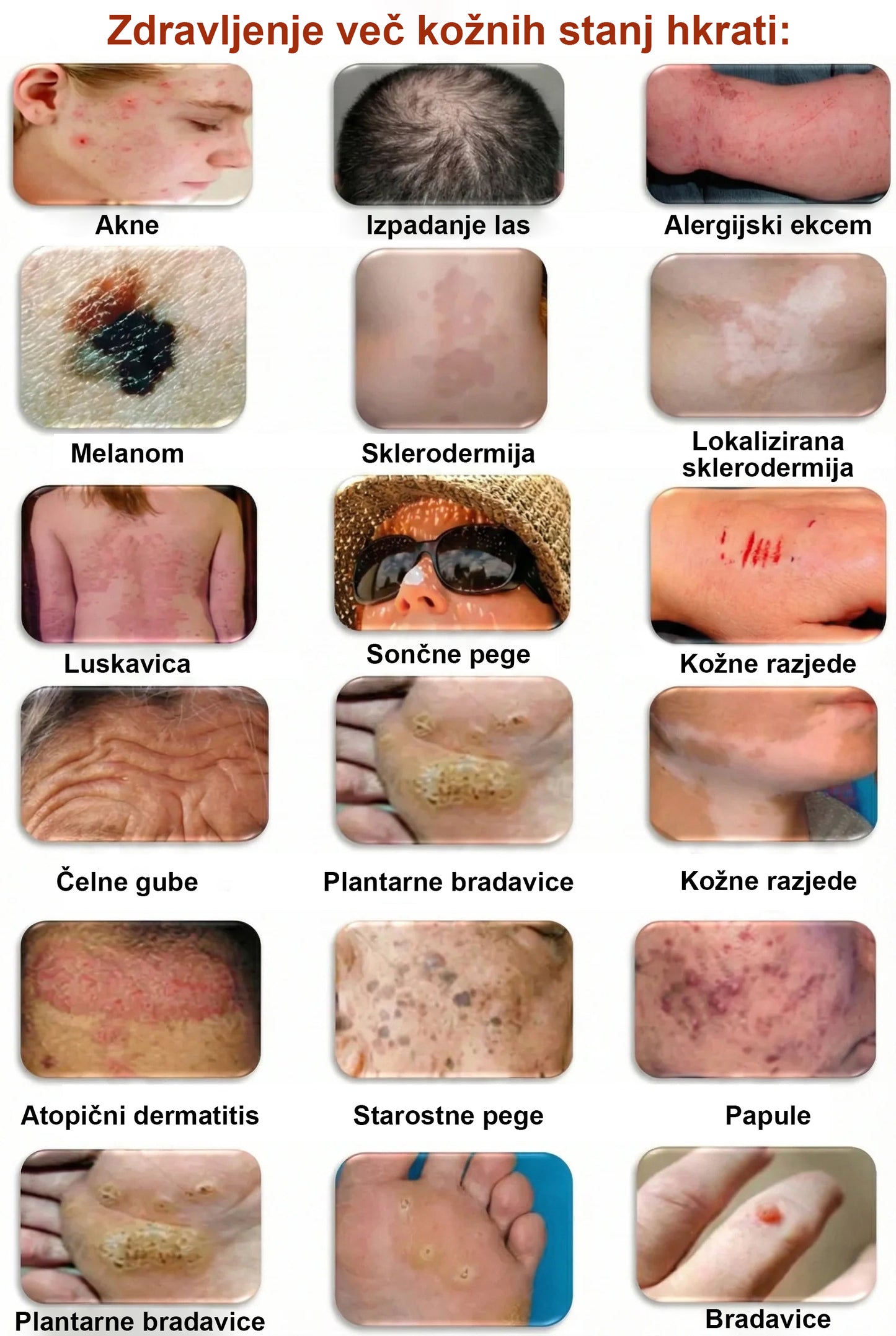 ✨ Twisma® Crema Pro za odstranjevanje bradavic in madežev 🧑‍⚕️ Hitro olajšanje in vidni rezultati že v samo 2 tednih