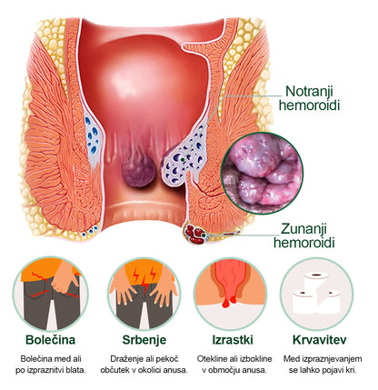 Trilumia® SootheMist PRO – Hitro olajšanje bolečin in krvavitev pri hemoroidih 🔥 100 % naravno zeliščno, brez dodatkov